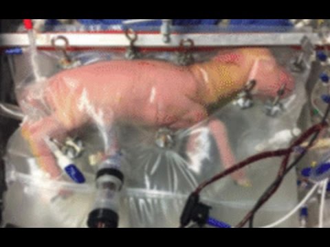 An artificial womb successfully grew baby sheep — and humans could be next