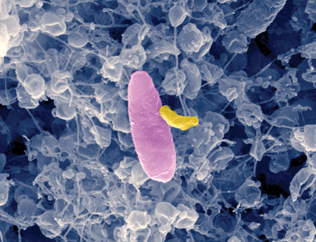 De vampierbacterie (geel) valt een Pseudomonas-cel aan. Bron: UNJ
