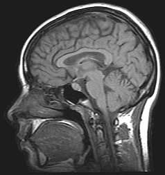 Een hedendaagse scan met MRI. (Wikimedia commons)