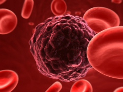 Een kankercel omringd door rode bloedlichaampjes. Bron [2]
