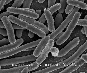 E. coli. Wikimedia Commons